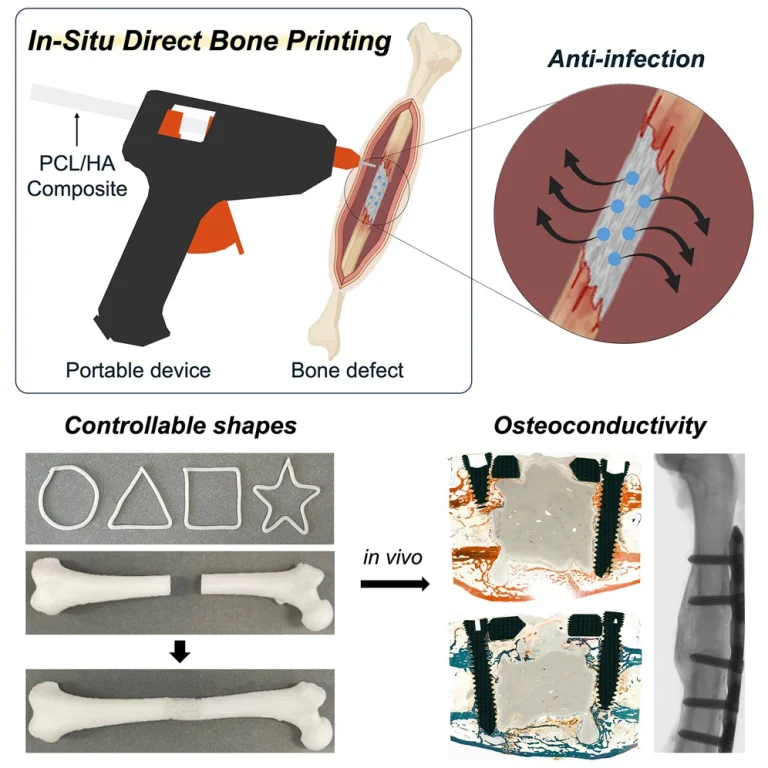 in-situ direct bone printing