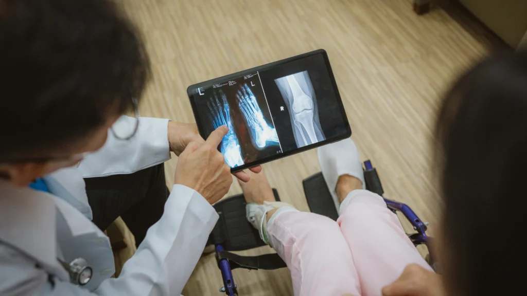 محققان تفنگ چسب حرارتی اصلاح‌شده‌ای را توسعه دادند که می‌تواند استخوان چاپ کند