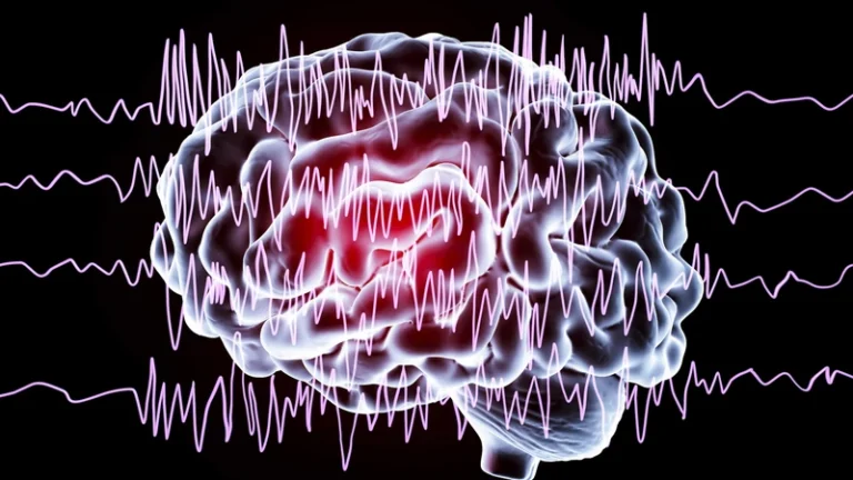 Engineer finds his smart sleep mask can read other people's brainwaves due to poor software security — superpower granted via poor-quality software with hardcoded high-level credentials | Tom's HardwareTom's Hardware